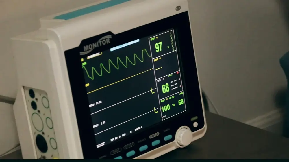 ECG